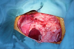 腫瘍外科6-9
