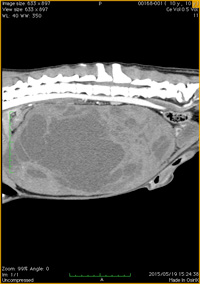 巨大な肝臓腫瘤