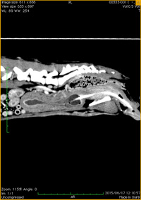 膀胱−尿道移行上皮癌
