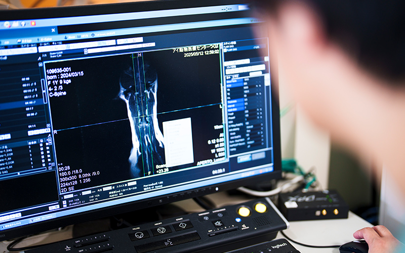 MRI検査時の注意事項